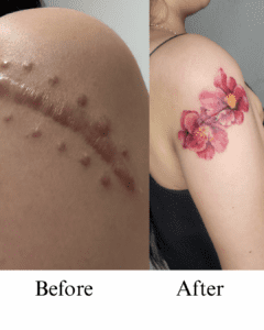Cover Up Tattoos in Calgary: Turn Old Ink Into Custom Art